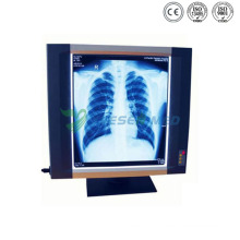 Ysx1704 Hospital X Ray Film Viewer